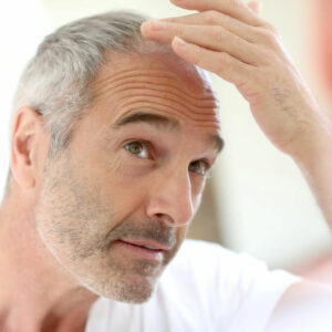 Essential Vitamins for Preventing Hair Loss