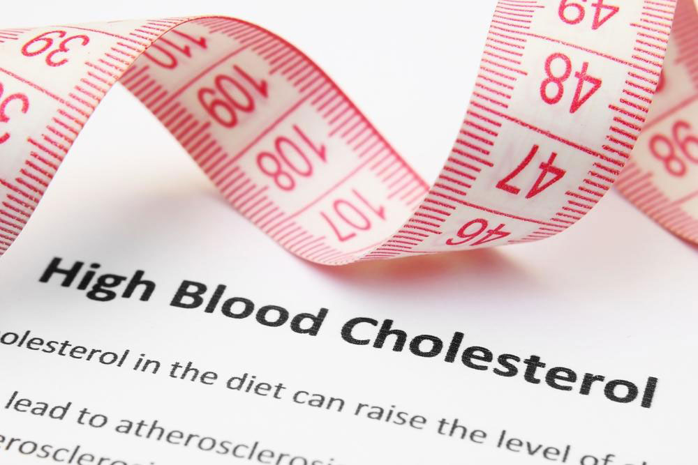 High Cholesterol &#8211; Symptoms and Treatment Options