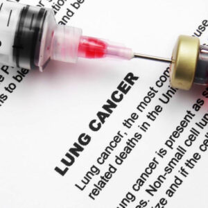 Remedies to Manage the Side Effects of Lung Cancer Treatments