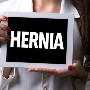 Treatment Options for a Hiatal Hernia